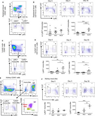 Different Spatial and Temporal Roles of Monocytes and Monocyte-Derived Cells in the Pathogenesis of an Imiquimod Induced Lupus Model